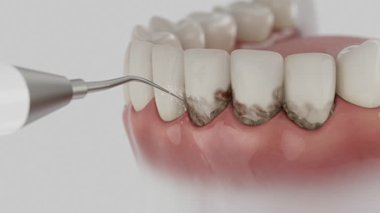 Trusted Dental Crowns And Bridges service in Deer Park, IL - Dentist Open Now